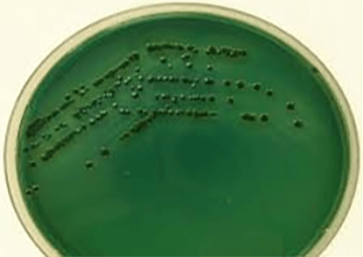 vibrio3 vibrio3